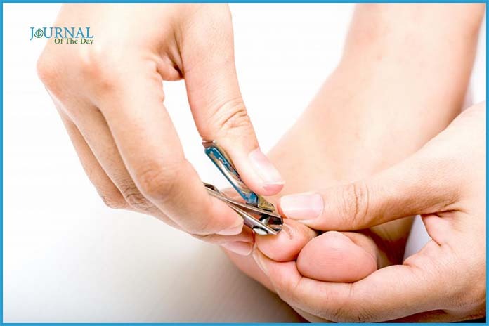 How to Treat Nail Fungus For Guaranteed Comfort?