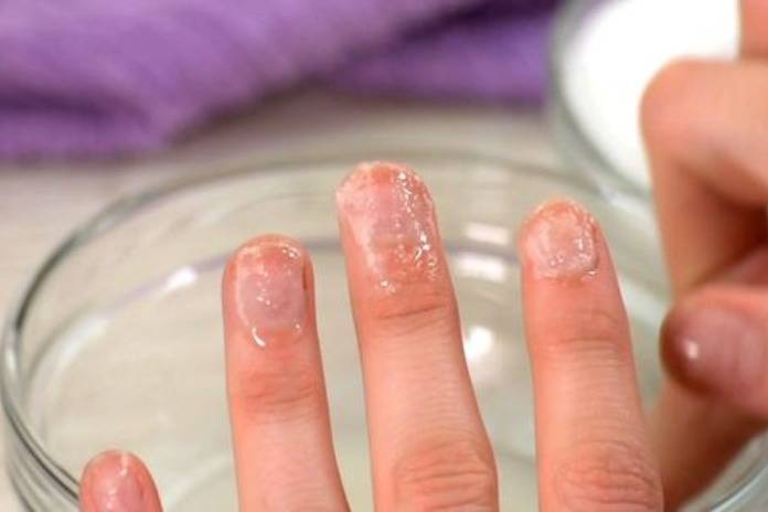 how to get glue on nails off