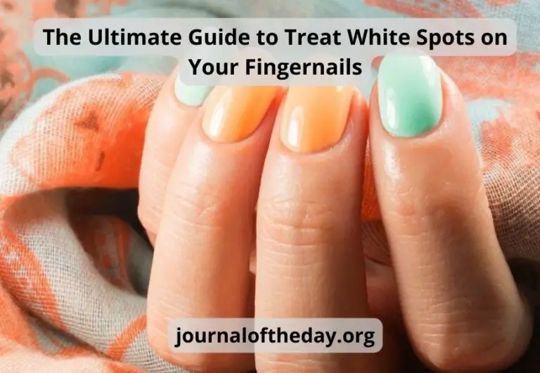 The Ultimate Guide to Treat White Spots on Your Fingernails